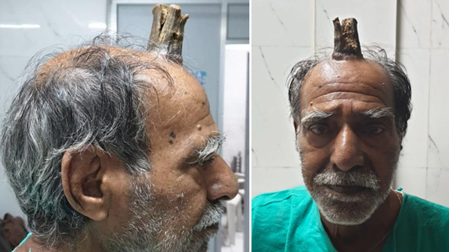 devils horn on old man head