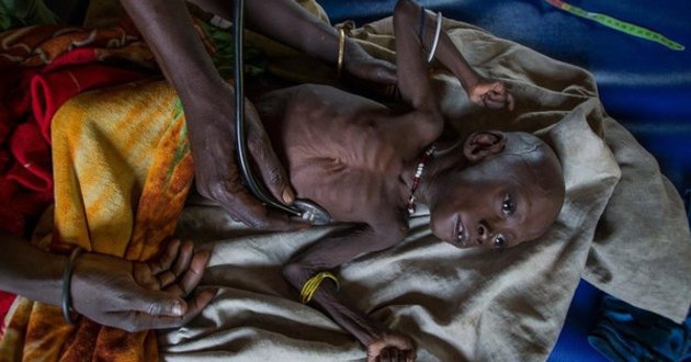 famine in south sudan one