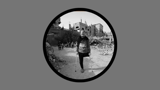 ইসরায়েলি নিষেধাজ্ঞায় গাজায় কৃত্রিম অঙ্গের সংকটে হাজারো যুদ্ধাহত