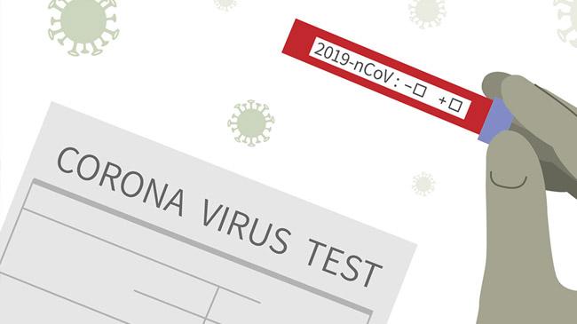 general kit virus test