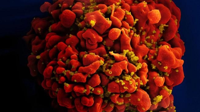hiv super strain found netherland inner