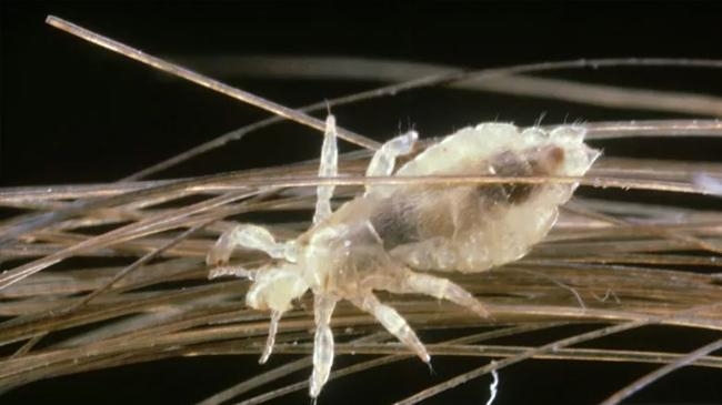 human dna found in lice on 2000 year old mummy