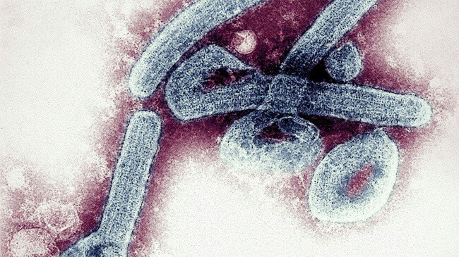 marburg virus