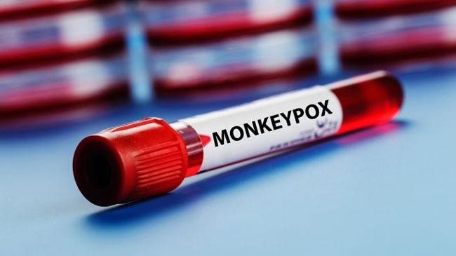 monkeypox