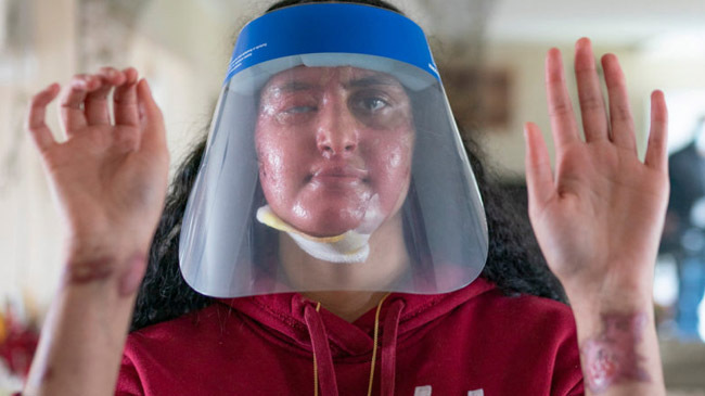muslim woman acid thrown new york