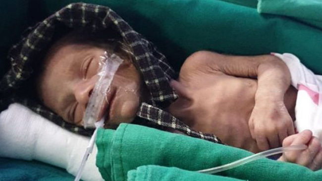 newborn resque from grave