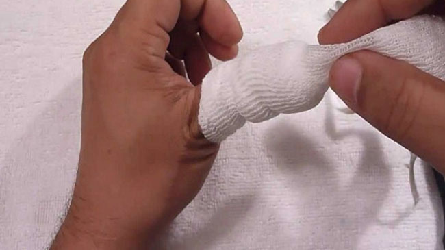 patient cut finger