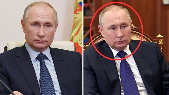 putins illness