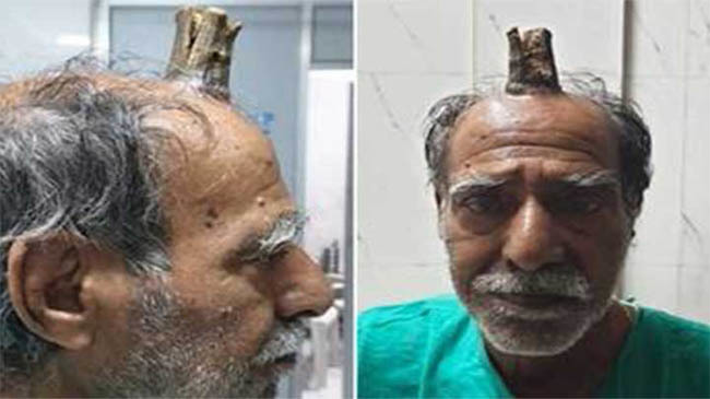 shamlal devils horn