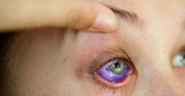 tatoo in eyes 2