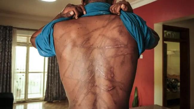 uganda tortured custody