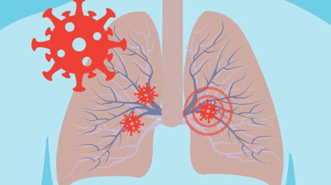 what happens to people lungs when they get infected