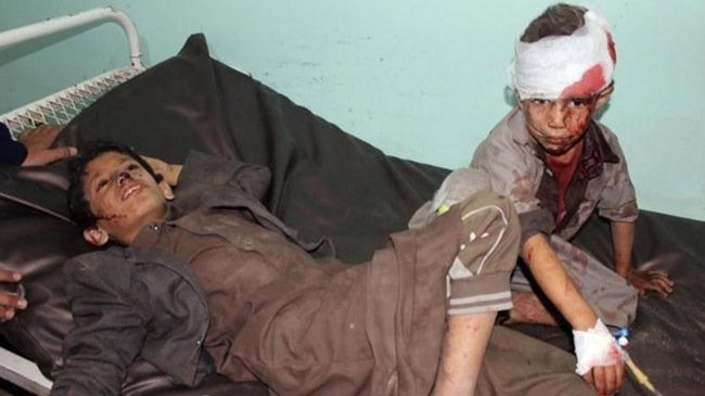 yemeny child saudi air strike